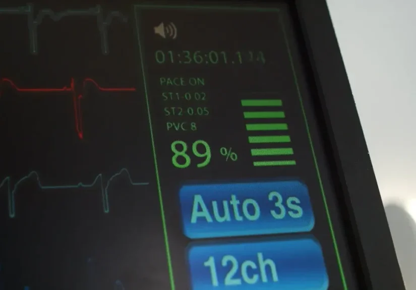 Battery Life and Portability: Choosing the Right ECG Monitor
