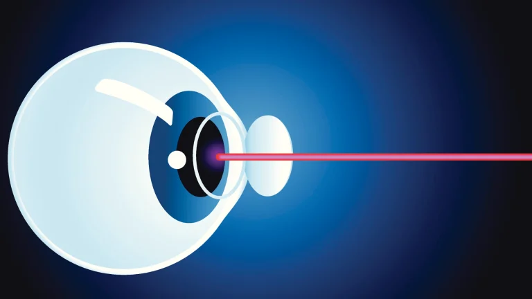 Saying Goodbye to Blurry Vision: The Benefits of Cataract Surgery