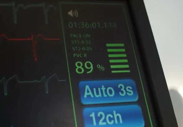 Battery Life and Portability: Choosing the Right ECG Monitor
