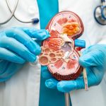 kidney care careers