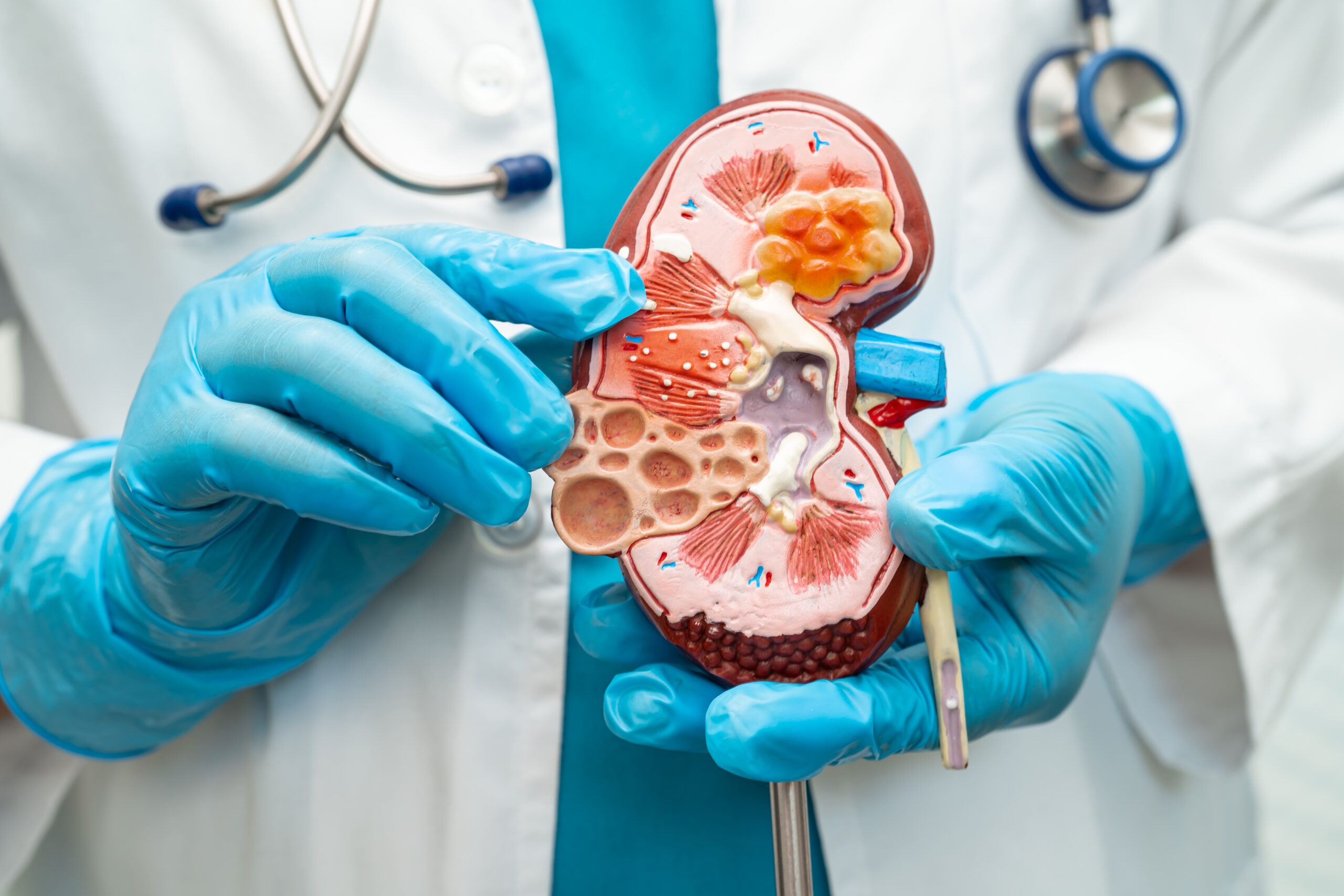 kidney care careers